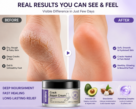 Advance Foot Crack Repair Cream 100 ml