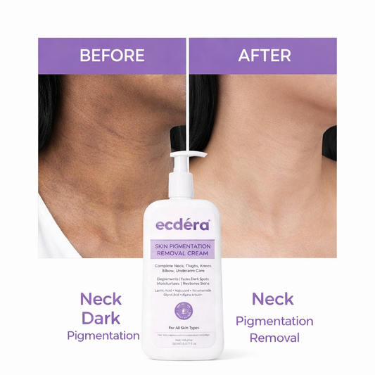 Skin Brightening & Pigmentation Repair Cream