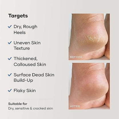Advance Foot Crack Repair Cream 100 ml