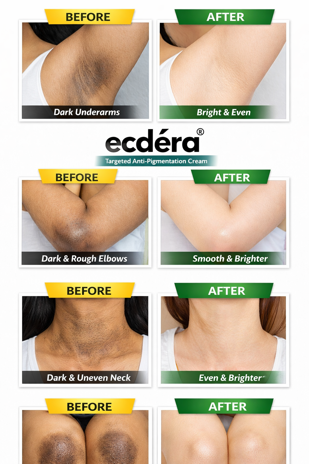 Skin Brightening & Pigmentation Repair Cream