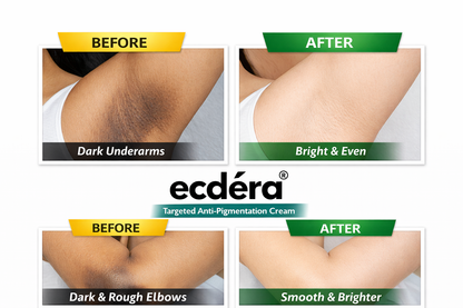 Skin Brightening & Pigmentation Repair Cream
