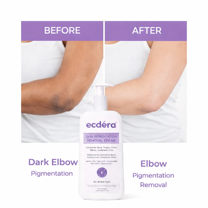 Skin Brightening & Pigmentation Repair Cream