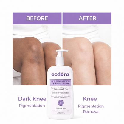 Skin Brightening & Pigmentation Repair Cream